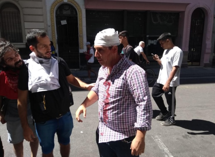 Así quedó Mauro Fulco, periodista de C5N, tras la agresión de manifestantes.