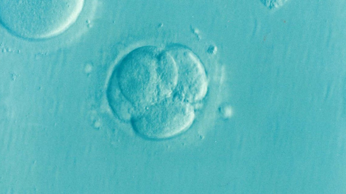 Cómo la inteligencia artificial está transformando los tratamientos de fertilidad