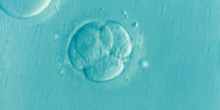 Cómo la inteligencia artificial está transformando los tratamientos de fertilidad