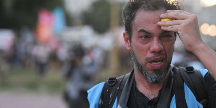 Alerta por trabajadores de prensa heridos durante la represión frente al Congreso 