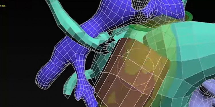 La UNCUYO y el Hospital Lencinas realizarán prótesis con tecnología 3D