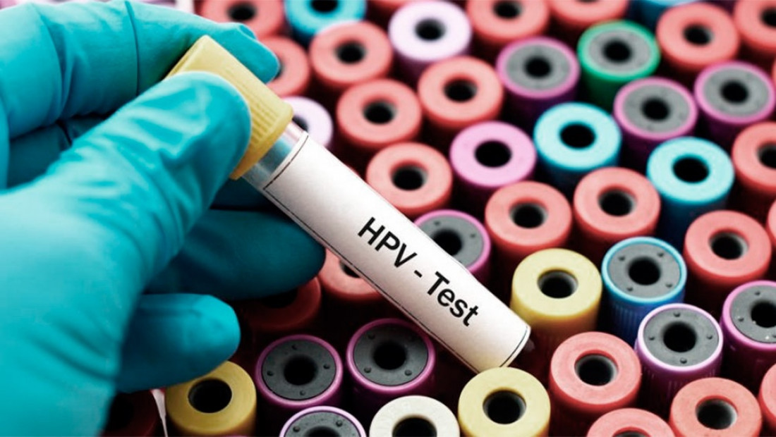 A 10 años de la vacunación contra el VPH, lanzan un estudio para medir su impacto en el país