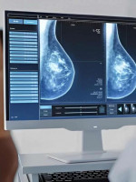 Cáncer de mama: una nueva terapia inhibe el crecimiento de tumores