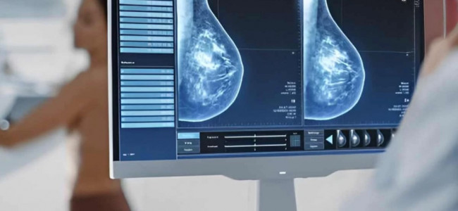 Cáncer de mama: una nueva terapia inhibe el crecimiento de tumores