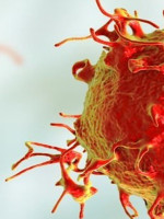 En 30 años, el diagnóstico de la leucemia más frecuente en hombres aumentó el 35%