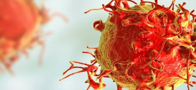 En 30 años, el diagnóstico de la leucemia más frecuente en hombres aumentó el 35%