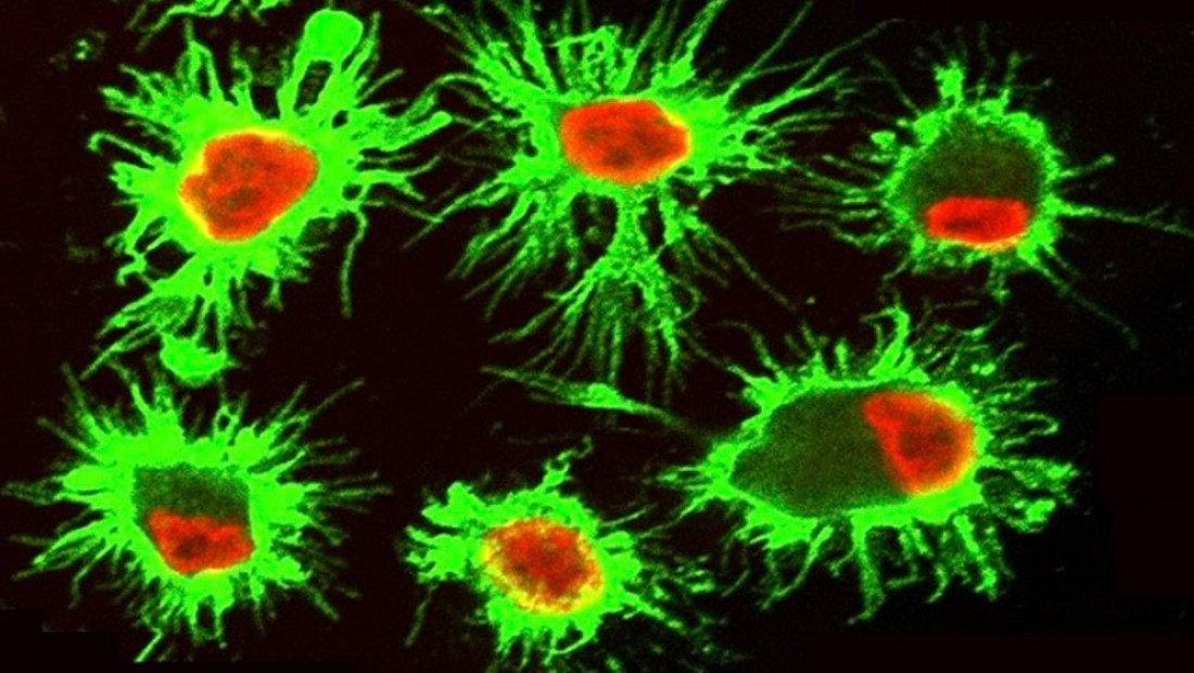 Descubren una estrategia de células del sistema inmune para sobrevivir en microambientes tumorales tóxicos