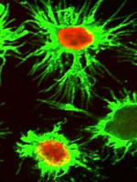 Descubren una estrategia de células del sistema inmune para sobrevivir en microambientes tumorales tóxicos