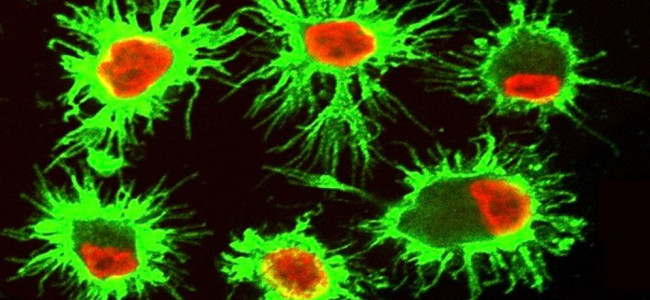 Descubren una estrategia de células del sistema inmune para sobrevivir en microambientes tumorales tóxicos