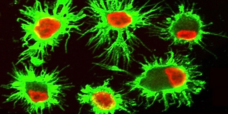 Descubren una estrategia de células del sistema inmune para sobrevivir en microambientes tumorales tóxicos