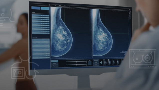 imagen Estudian cómo la IA aporta mayor precisión en el diagnóstico del cáncer de mama
