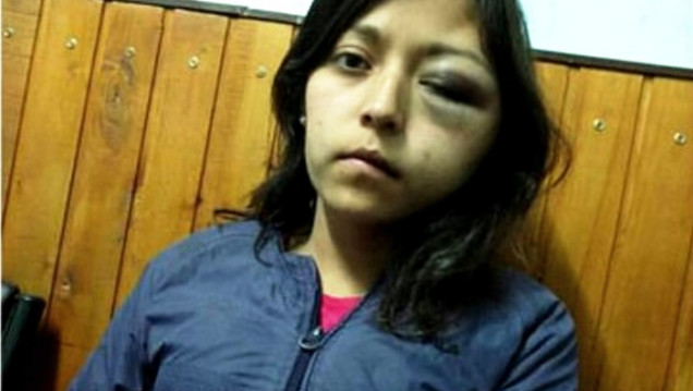 imagen Detuvieron al acusado de desfigurar a su expareja
