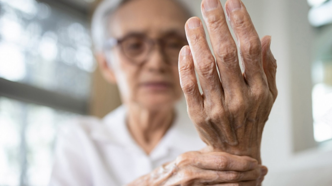 Artritis reumatoidea: 400 mil personas la padecen en Argentina y muchas tardan en ser diagnosticadas