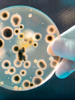 Realizaron en Argentina un estudio sobre mortalidad por bacterias resistentes a medicamentos