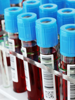 Una biblioteca de vida: crean el primer Biobanco Nacional de muestras biológicas 