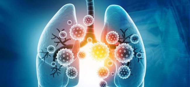 Por los controles postcovid, se diagnosticaron más tumores de pulmón en estadíos tempranos
