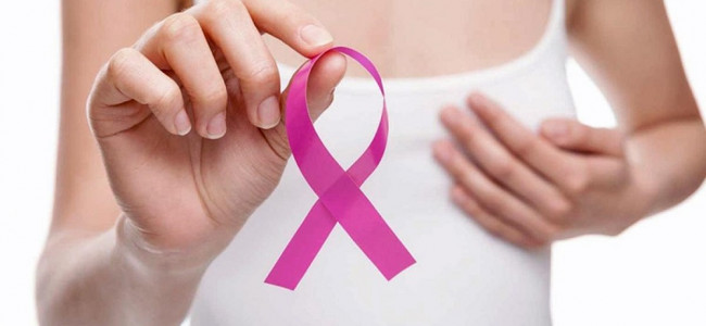 Campaña de Damsu: mujeres de entre 40 a 70 años se podrán realizar mamografías gratuitas 