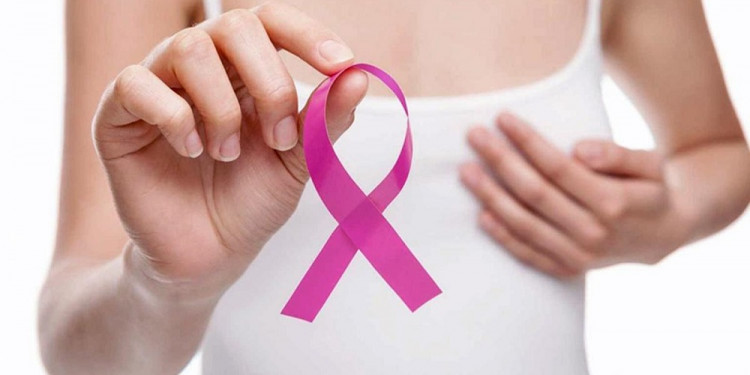 Campaña de Damsu: mujeres de entre 40 a 70 años se podrán realizar mamografías gratuitas 