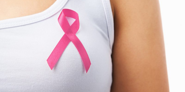 Cáncer de mama: ayudarán a mujeres con mastectomía y sin obra social