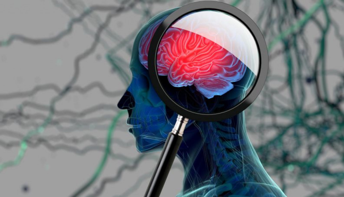 Un software de desarrollo argentino podría diagnosticar de forma precoz el Alzheimer