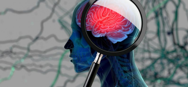 Un software de desarrollo argentino podría diagnosticar de forma precoz el Alzheimer