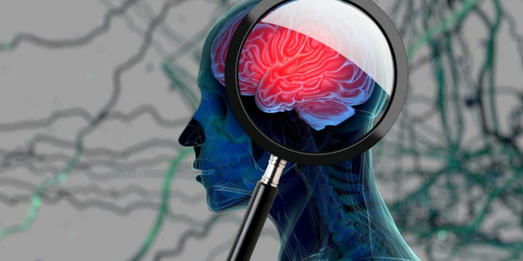 Un software de desarrollo argentino podría diagnosticar de forma precoz el Alzheimer