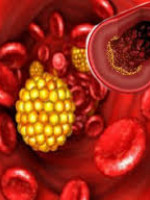 Factores de riesgo: triglicéridos y colesterol alto
