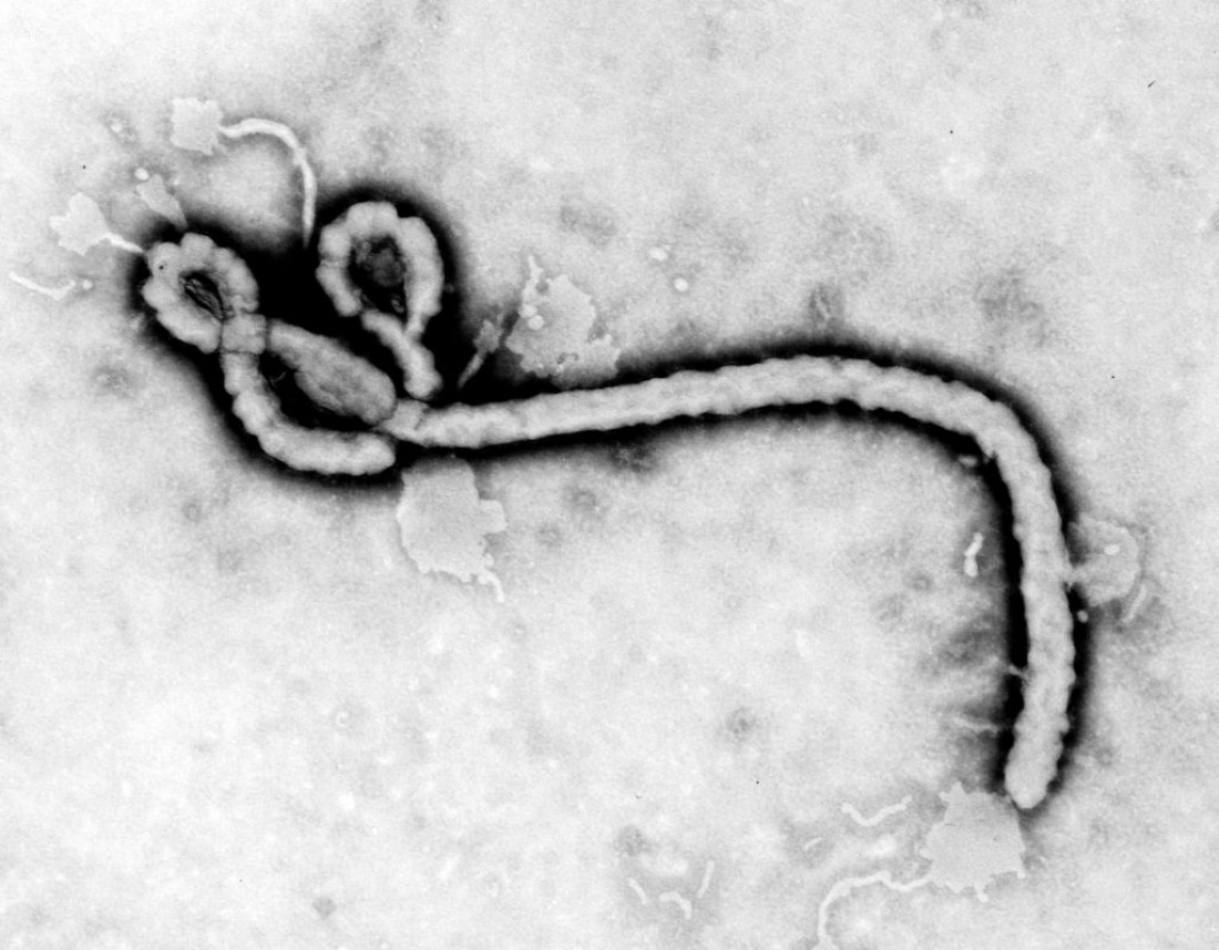 Ébola: "En Argentina estamos preparados a través de los protocolos del Ministerio de Salud", afirmó la Dra. Atorri