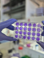 Hallan un mecanismo común de replicación para los virus del dengue, Zika y fiebre amarilla