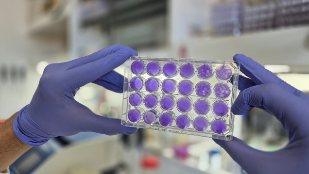 imagen Hallan un mecanismo común de replicación para los virus del dengue, Zika y fiebre amarilla