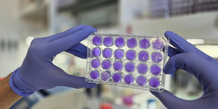 Hallan un mecanismo común de replicación para los virus del dengue, Zika y fiebre amarilla