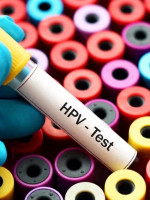 Uno de cada tres varones tiene HPV y en uno de cada cinco es de alto riesgo