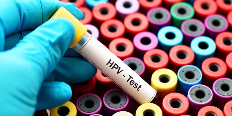 Uno de cada tres varones tiene HPV y en uno de cada cinco es de alto riesgo