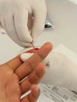 Test de VIH gratuito en Medicina