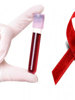 ¿Puede el VIH no estar vinculado con la enfermedad del SIDA?