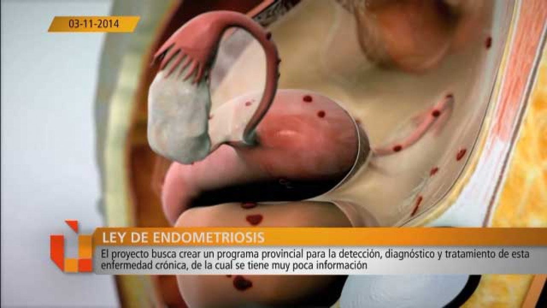 Lorena Meschini sobre la Ley de Endometriosis