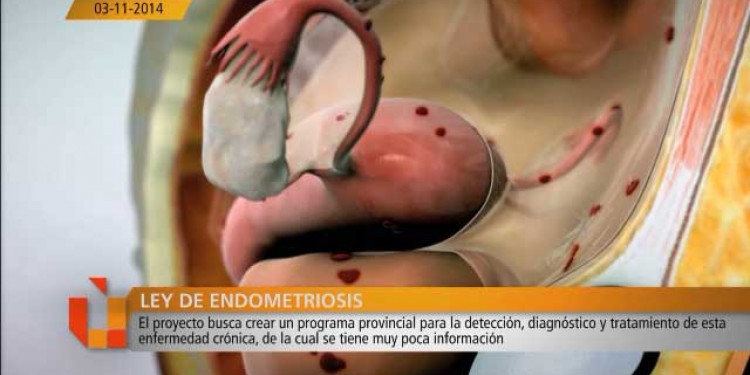 Lorena Meschini sobre la Ley de Endometriosis