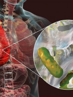 Conicet: encuentran la clave de la resistencia a antibióticos en un paciente con fibrosis quística