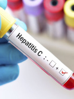 Solo el 18% de las personas diagnosticadas con hepatitis B y C realizan tratamiento 