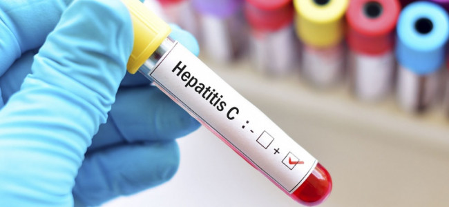 Solo el 18% de las personas diagnosticadas con hepatitis B y C realizan tratamiento 