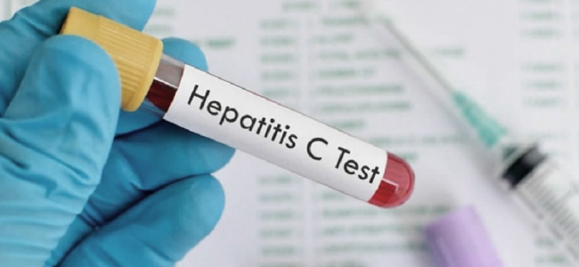 Estiman que solo el 50% de las personas con hepatitis C están diagnosticadas
