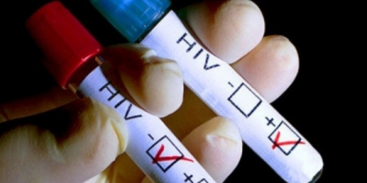 Aumentan las infecciones con VIH en adolescentes y mayores de 50 años