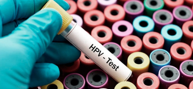 Cáncer cervicouterino: solo el 12% de las adolescentes a nivel mundial accede a la vacuna contra VPH