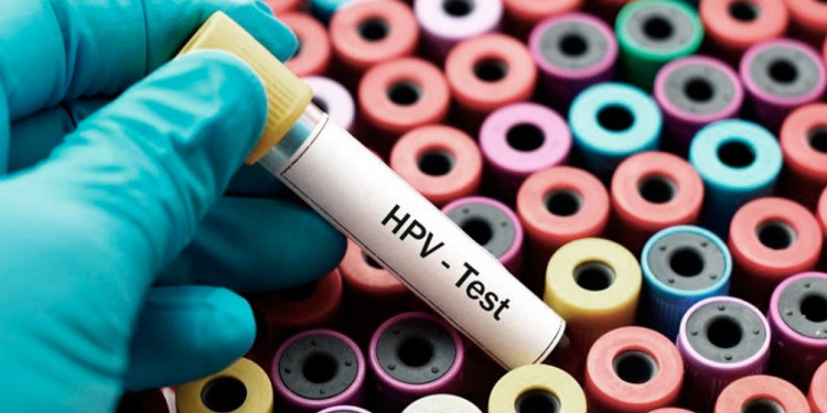 Cáncer cervicouterino: solo el 12% de las adolescentes a nivel mundial accede a la vacuna contra VPH