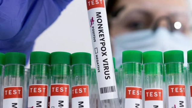 imagen Cinco preguntas clave sobre la viruela del mono, que ya registra casos en 15 países