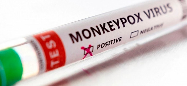Estados Unidos aprobó un test para detectar la viruela del mono