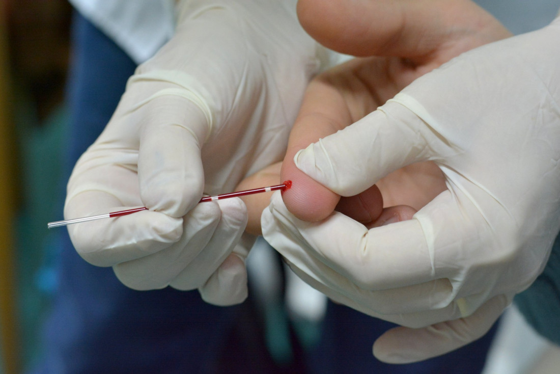 Ya funciona el nuevo servicio de consejería y testeo para VIH en la UNCuyo