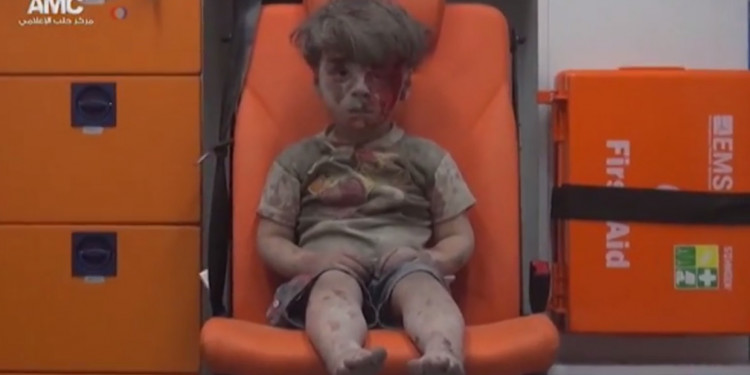 Omran, otro niño sirio herido que muestra el drama de los bombardeos