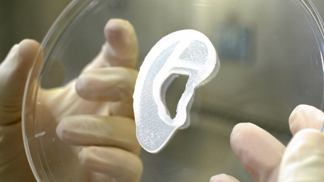 Trasplantan por primera vez una oreja impresa en 3D con células humanas