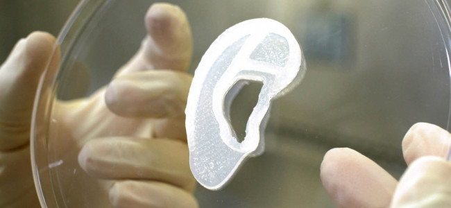 Trasplantan por primera vez una oreja impresa en 3D con células humanas